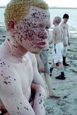 Watch Albino United Gomovies123