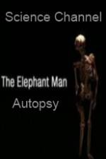 Watch Science Channel Elephant Man Autopsy Gomovies123