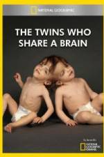Watch National Geographic The Twins Who Share A Brain Gomovies123